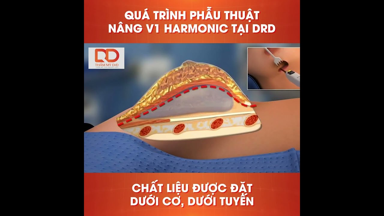 Bác sĩ phẫu thuật chuyển giới