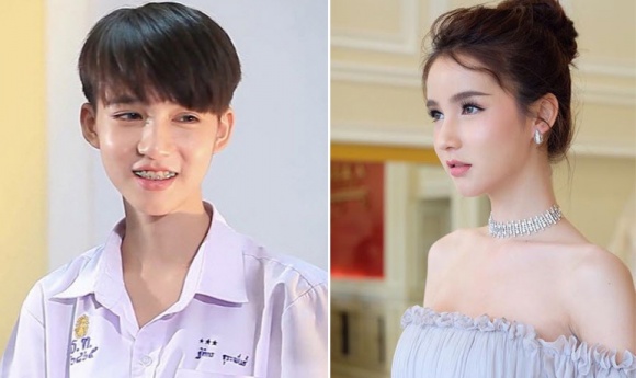 Phẫu Thuật Chuyển Giới Nữ Thành Nam