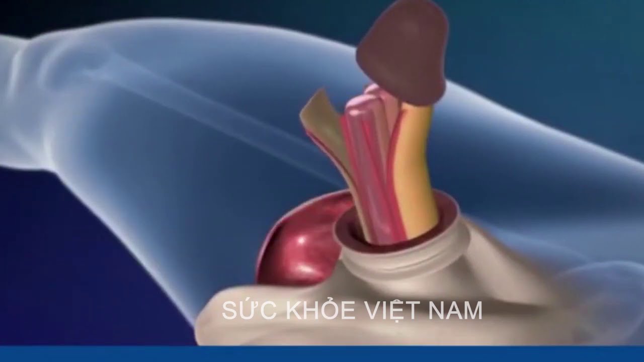 Quy trình phẫu thuật chuyển giới
